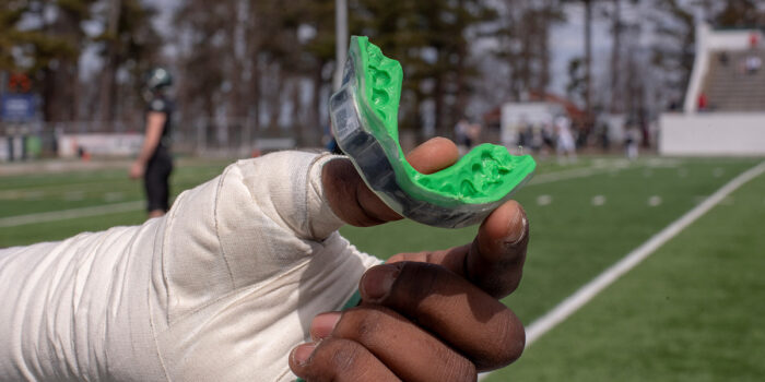 Lesiones dentales en el deporte