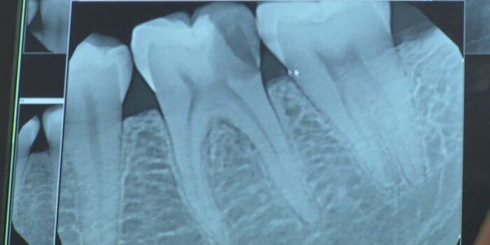 radiografía dental digital